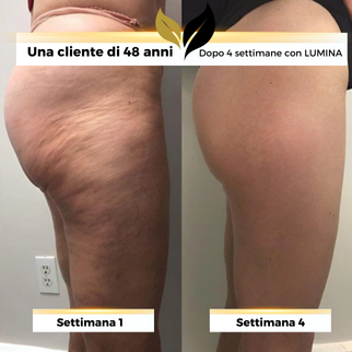 TONIKA-Olio Anti-Cellulite by Lumina